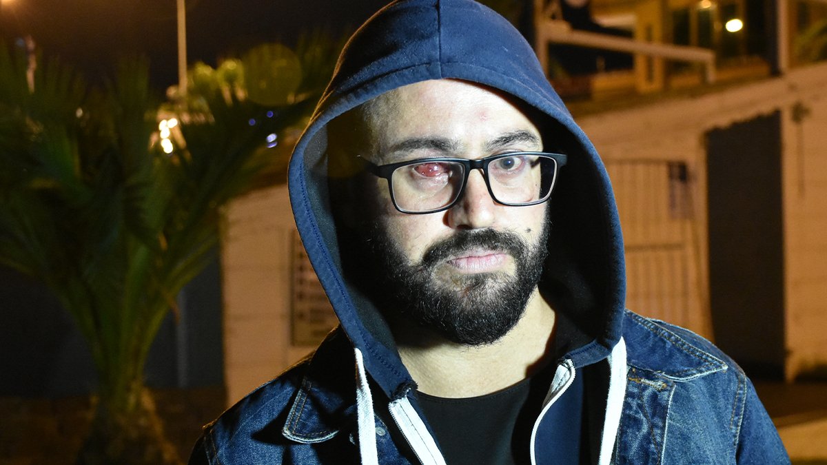 Kız arkadaşıyla tartışırken kabusu yaşadı: Genç adam bir gözünü kaybetti