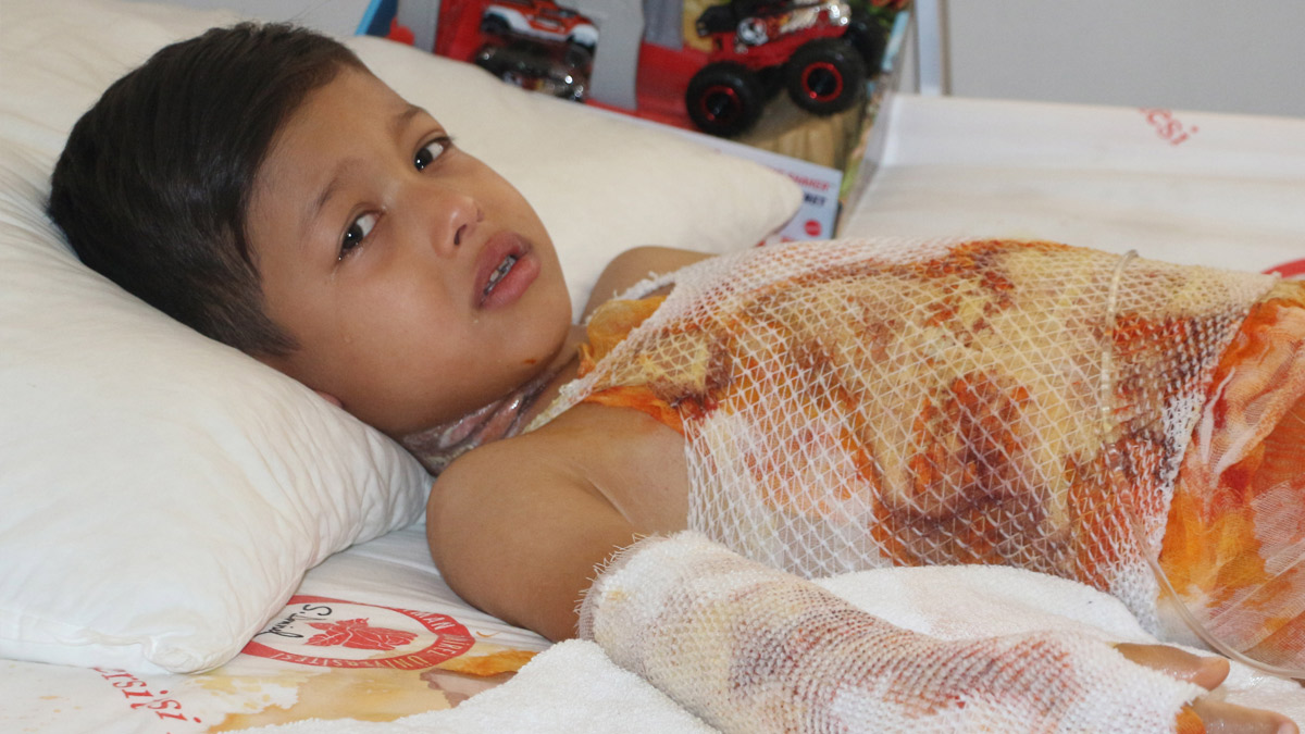 Anaokulunda etkinlik faciası! Küçük çocuğun üzerine kaynar su döküldü