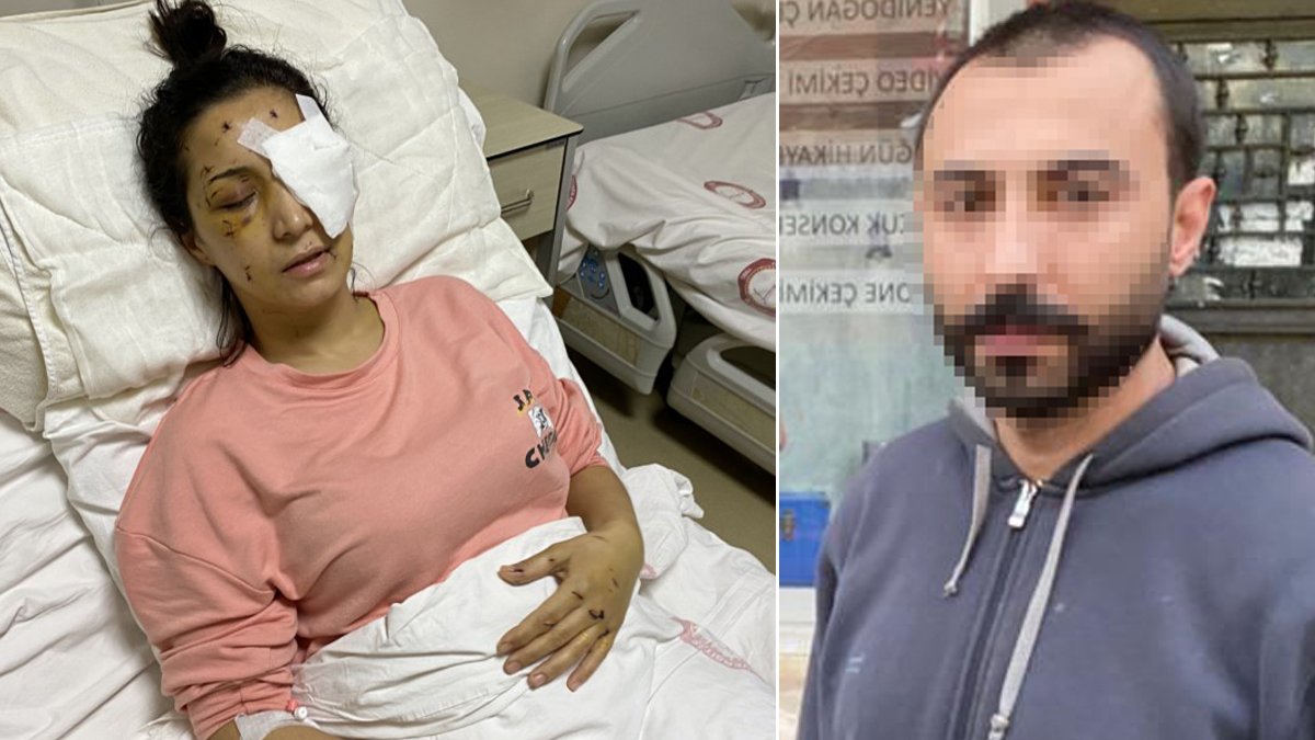 37 kez bıçaklayıp bir gözünü kaybetmesine neden oldu, mahkeme 15 yıl hapis cezası verdi
