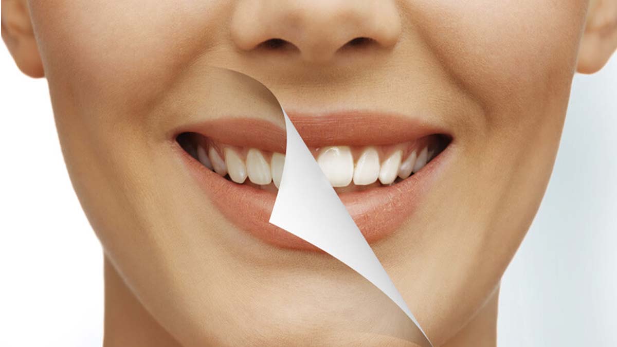 Bir gecede dişleri beyazlatmak hiç bu kadar kolay olmamıştı! Şimdi bu önerilerimizi deneyin!