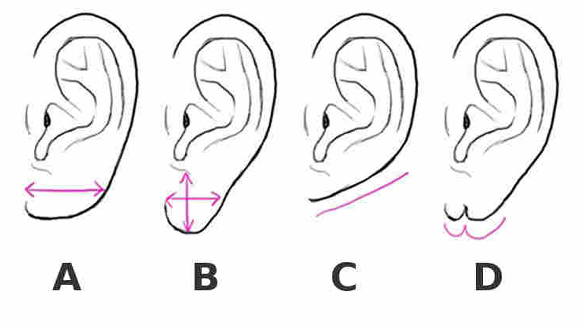 Kulaklarınızın şekli, kendinizi aşkta nasıl ifade ettiğinizi söylüyor! Denemek ve öğrenmek ister misiniz?