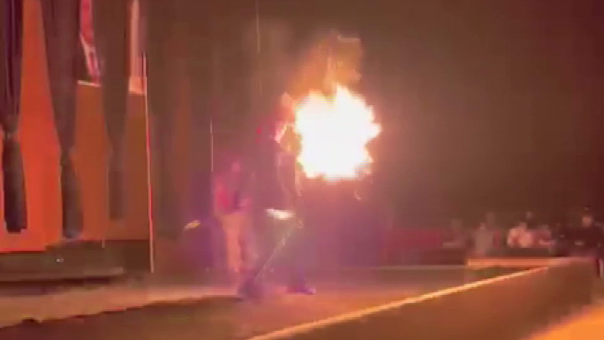 Çocuklara ateş gösterisi yaparken yüzü yandı