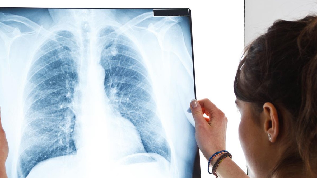 Havalar soğudu grip ve zatürre vakaları patladı