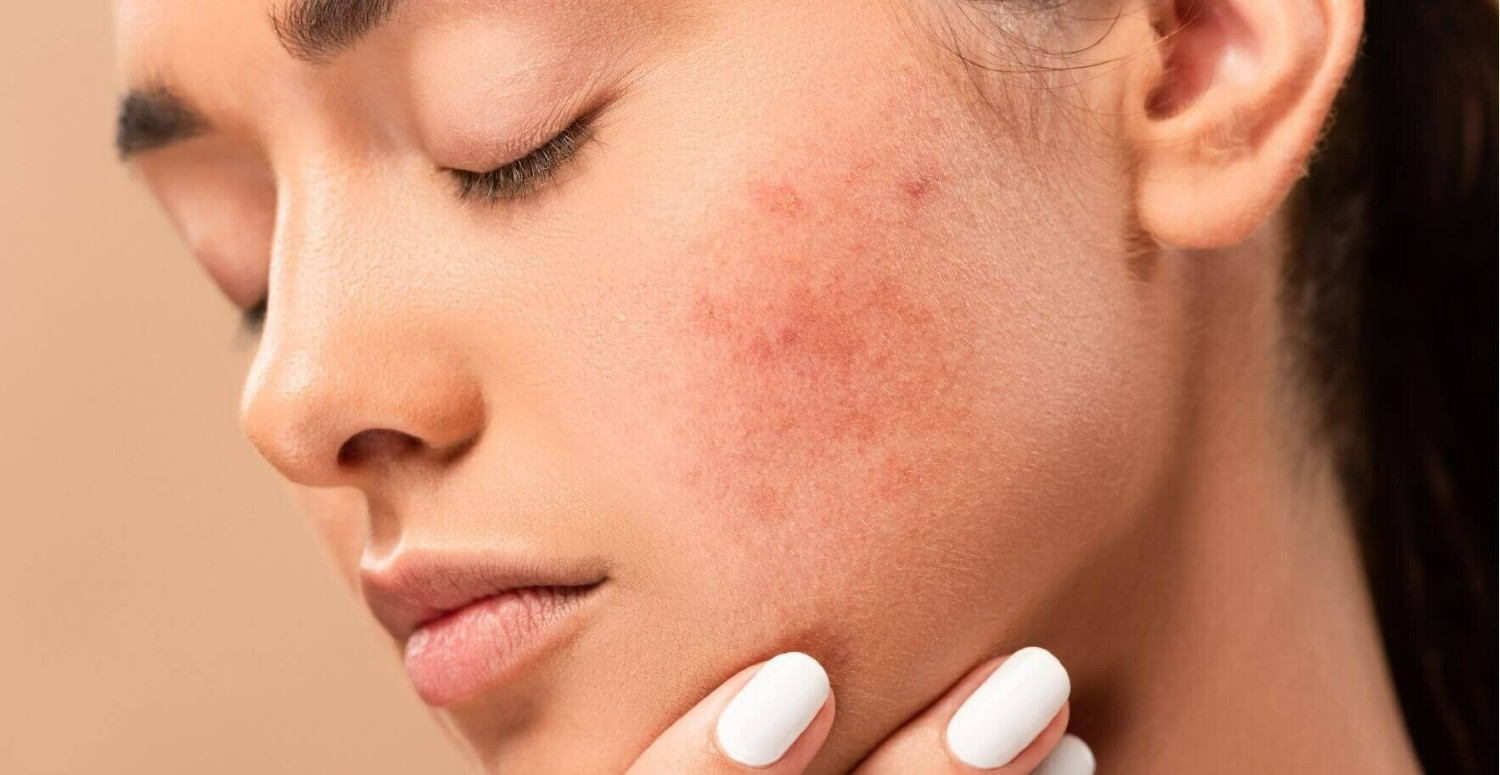 Bu besinin o işe yaradığını duyan hayretler içinde kalıyor! Cildinizi tazeleyerek ışıl ışıl yapacak 5 doğal mucizevi besin