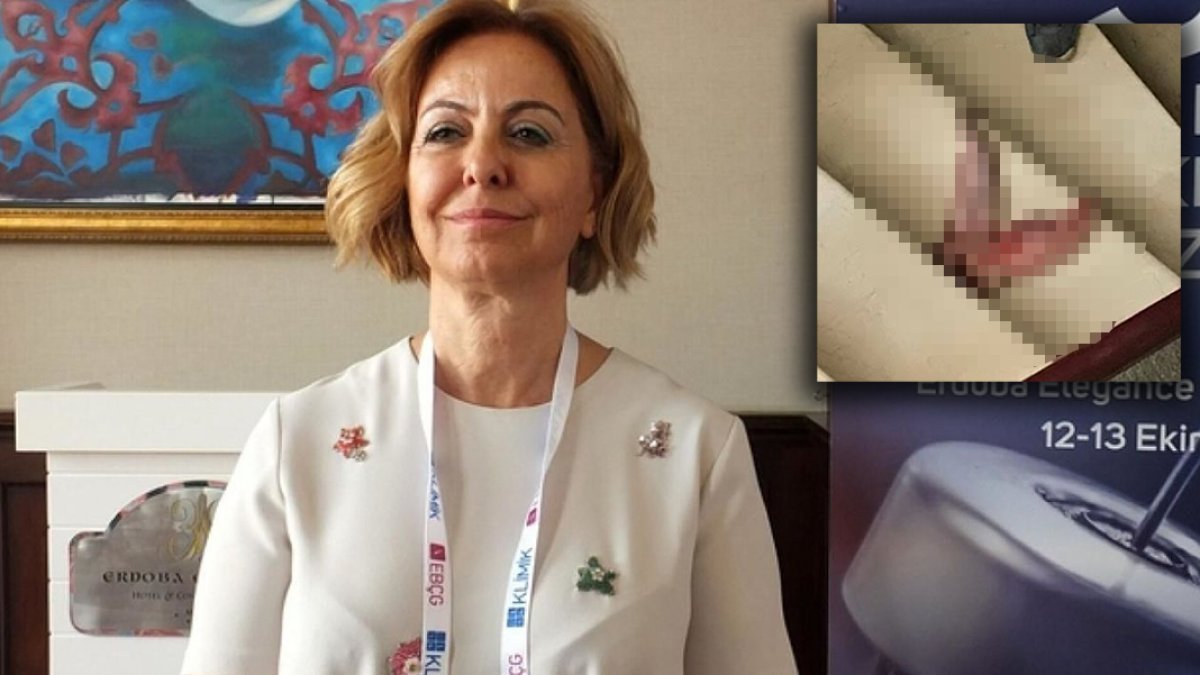 Prof. Dr. Esin Şenol'a 'dana dili' gönderen şüpheliye 10 yıl hapis talebi