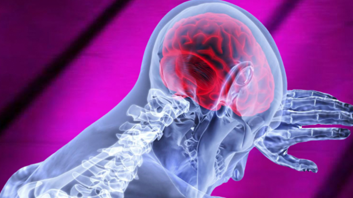 Yeni bir tespit: Kovid beyinde parkinsonla aynı hasarı bırakıyor