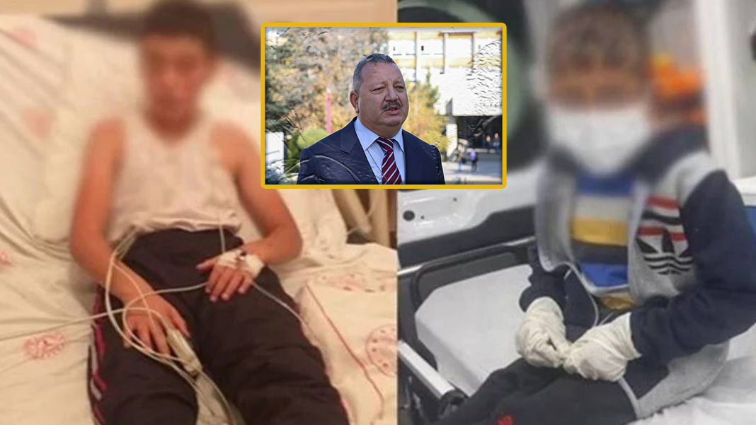 Kuduz köpek tarafından ısırılmıştı: Durumu çok kritik