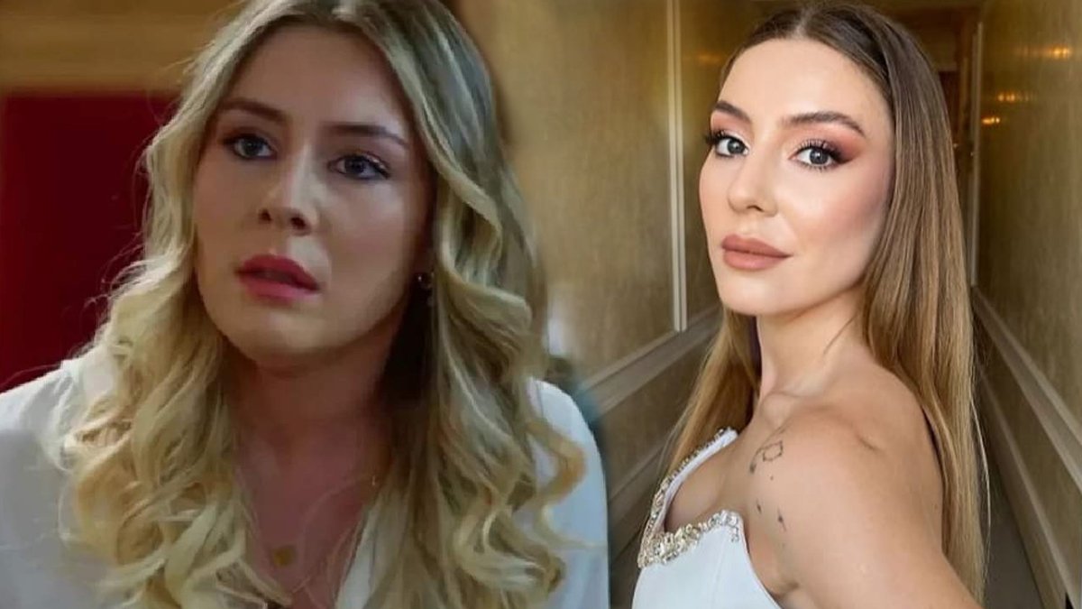 Duy Beni dizisinin Bahar Hocası da estetik güzeliymiş! Görenler doktorunu tebrik etti "Tepeden tırnağa yapma"