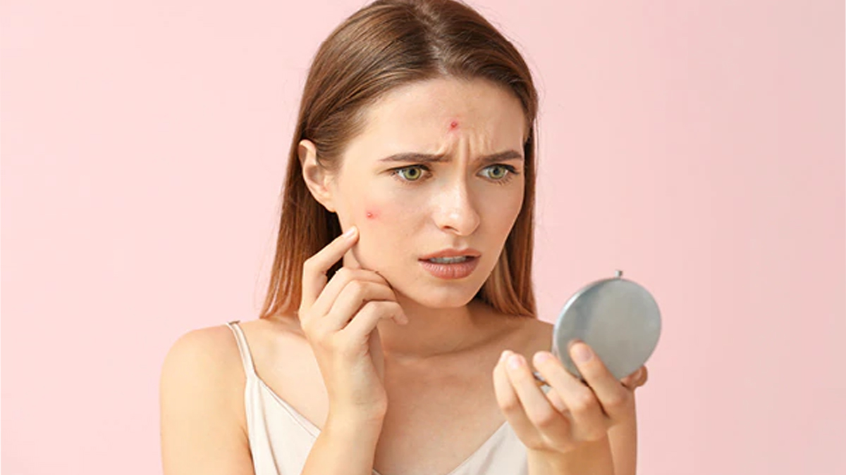 Cildinizi beyazlatma sorununu kökten çözüyor! İşte cildinizdeki lekeleri giderecek beyazlatacak o basit karışım