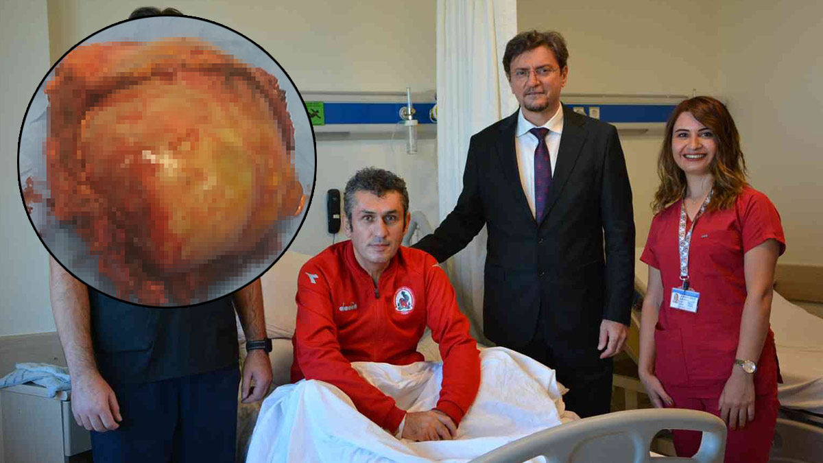 Göğsünden çıkan dev kitle, doktorları da şaşırttı