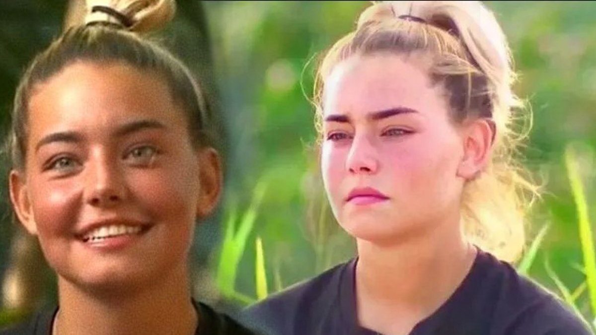 Survivor Aycan tanınmaz halde! Estetiği kaçırınca bakın ne hale düştü? "Yazık"