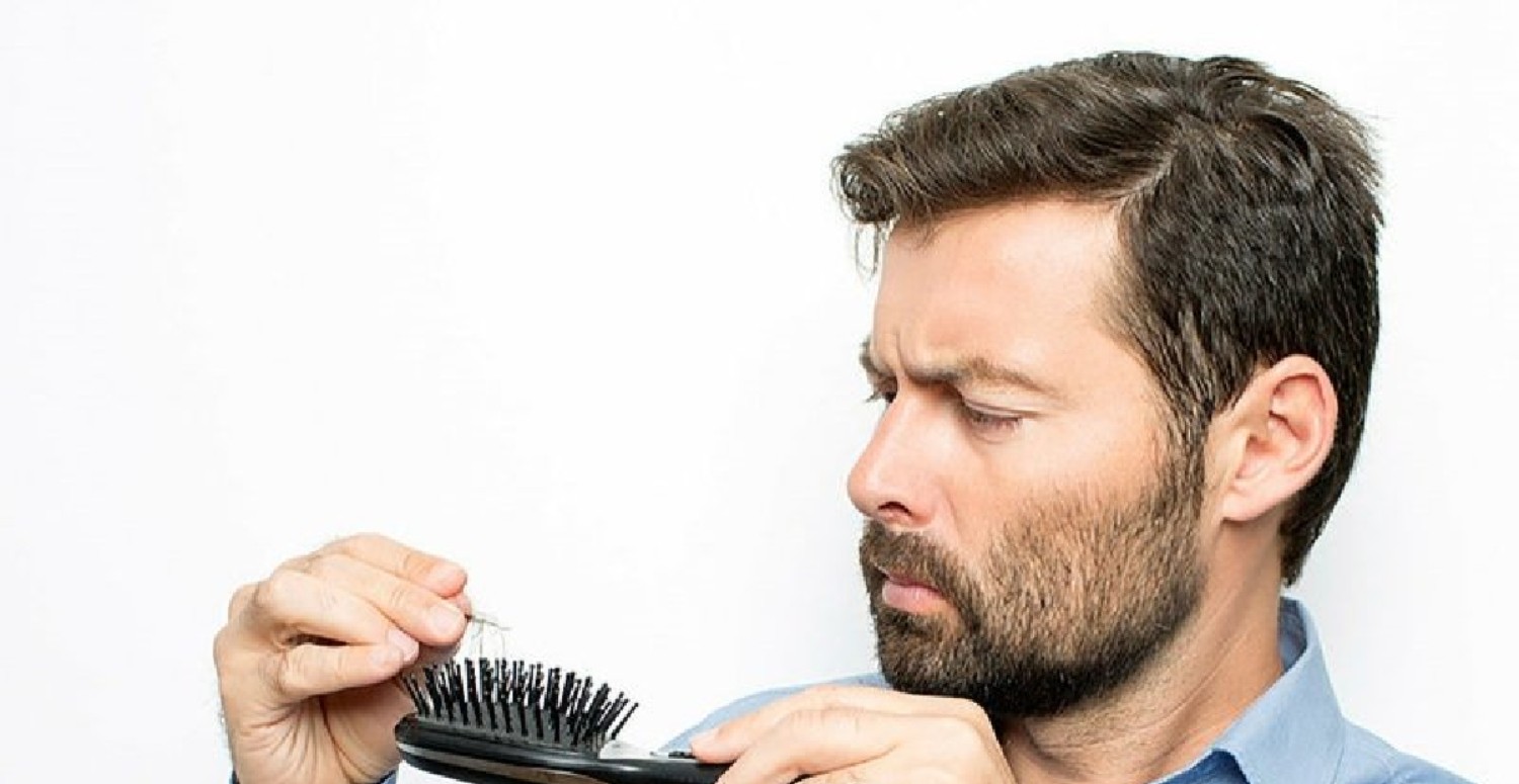 Kadınlarda erkek tipi saç dökülmesi nedir, neden olur ve nasıl