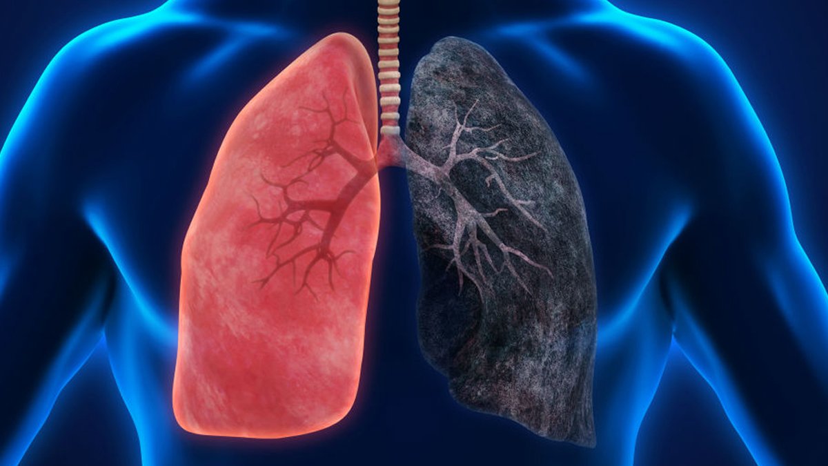 Sigara içenler mutlaka tüketmeli: Vücudunuzdaki nikotinden kurtulun ve yenilenin...