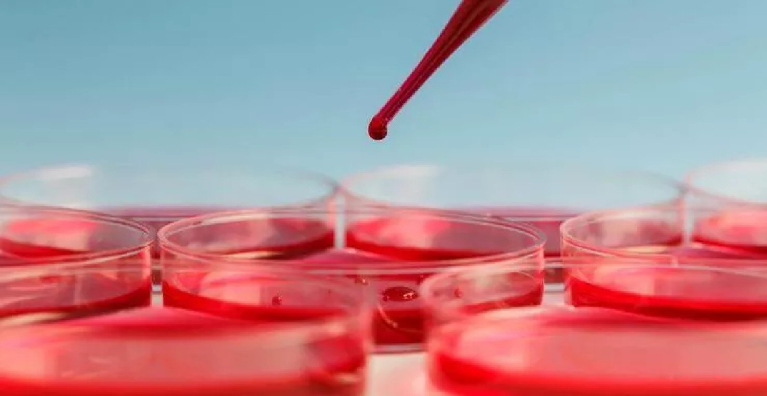 Bu kan grubunda olanlar dikkat! Eğer kan grubunuz buysa tehlikedesiniz! İşte hastalık riskleri