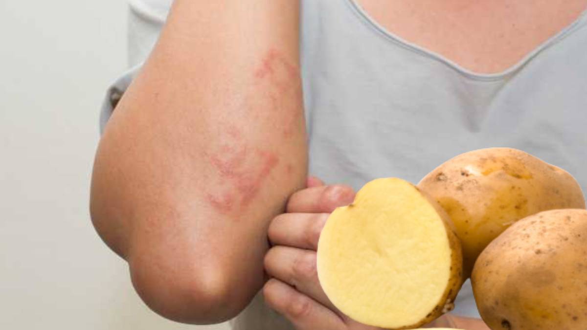 Kolunuza patates bastırın mucizeye tanık olun! Bu basit yöntem hayatınızı kurtaracak