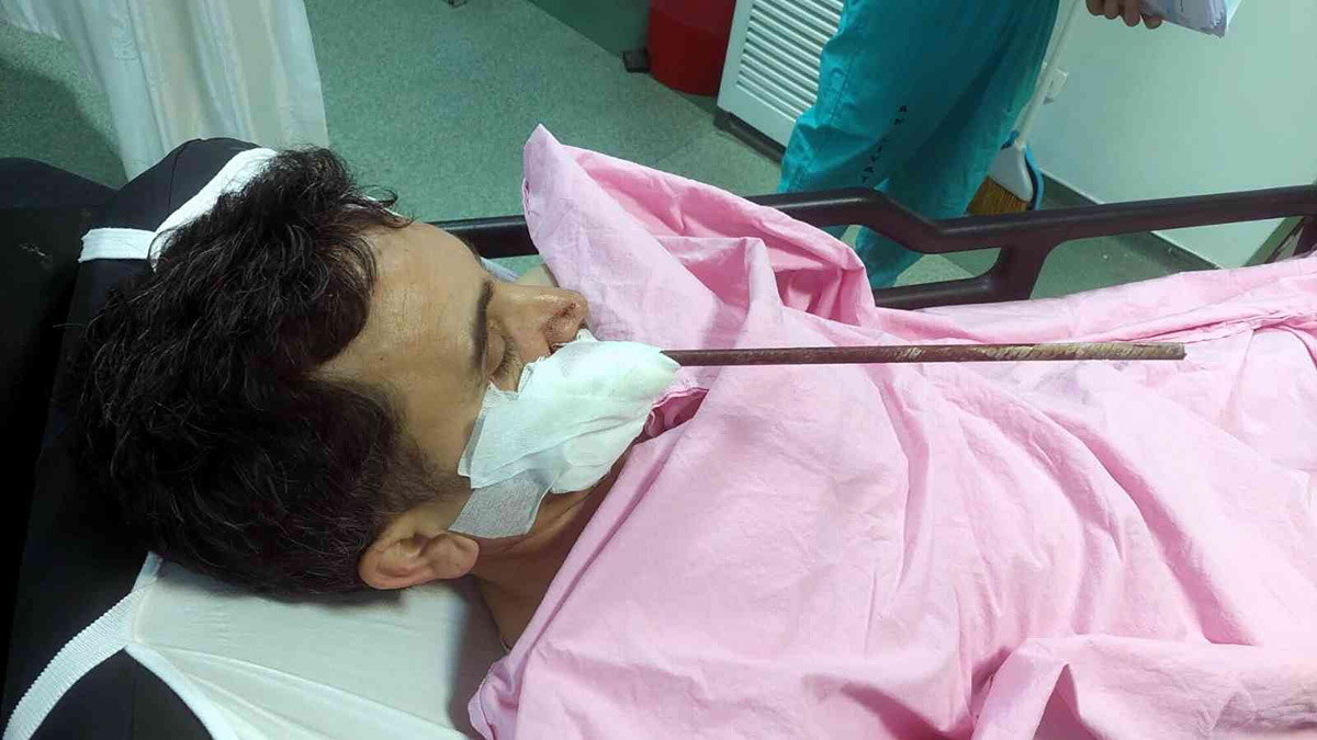 Yüzüne demir saplanmıştı! O işçi yoğun bakımdan çıktı