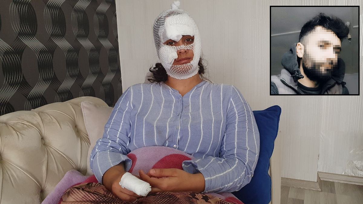 Erkek şiddetinin son mağduru Gülcan isyan etti: Ölen kadınlardan olmak istemiyorum