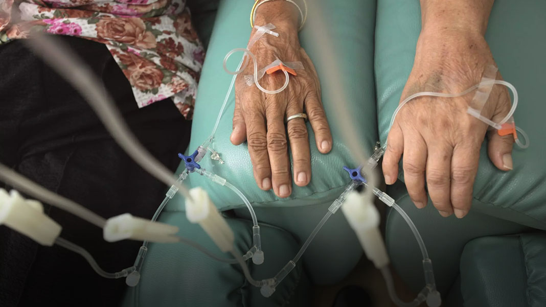 Kanser tarihe mi karışıyor? Türk doktordan umutlandıran açıklama