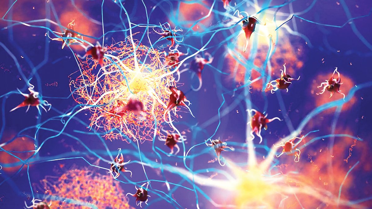 Alzaymır’a ilk fren