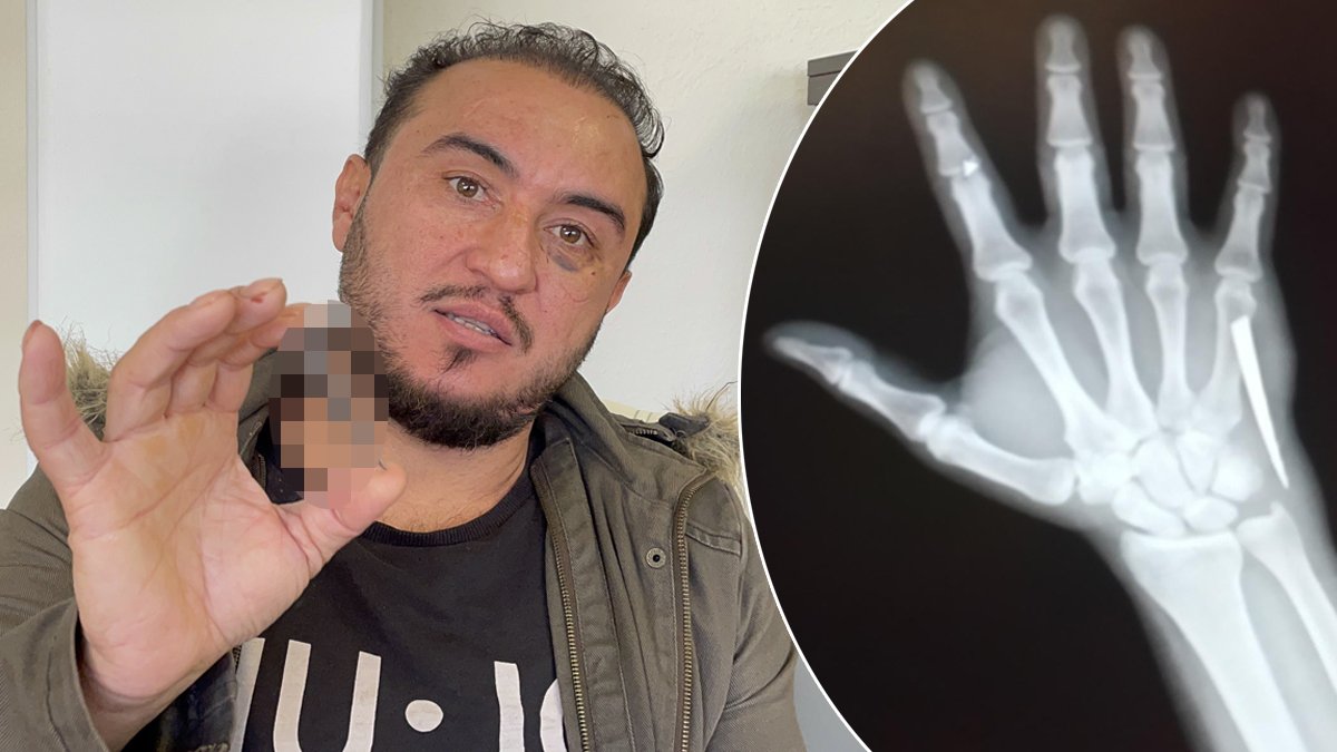 Acıya dayanamayınca gerçek ortaya çıktı! 2 ay boyunca bununla yaşamış