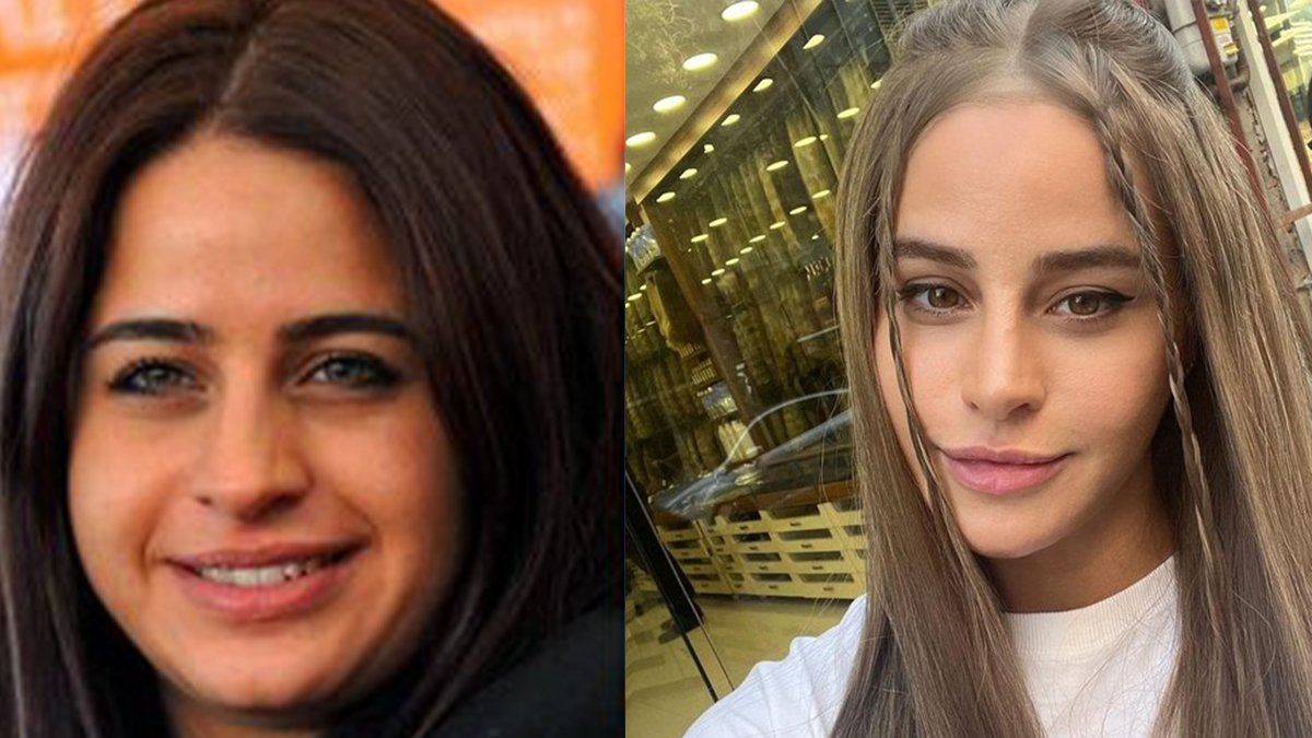 Büşra Pekin'in gençlik yöntemini duyan kırtasiyeye koştu! Estetik yerine bakın ne yaptırmış?