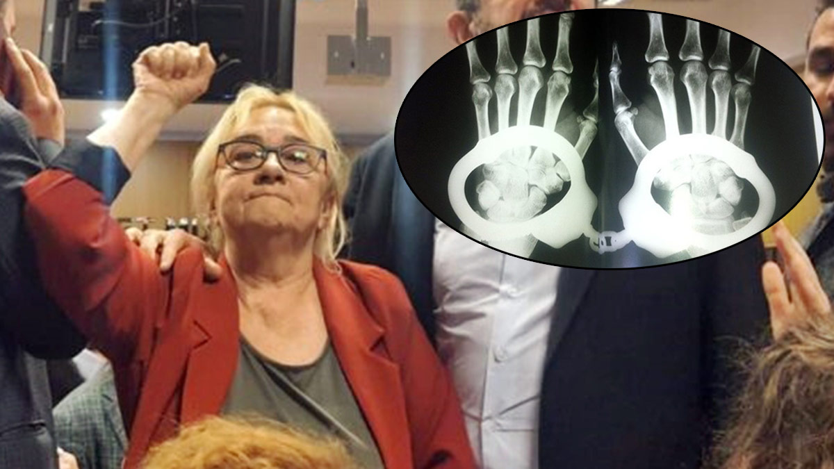 Mücella Yapıcı'nın kelepçeli muayenesine soruşturma izni çıkmadı: Rutin uygulama