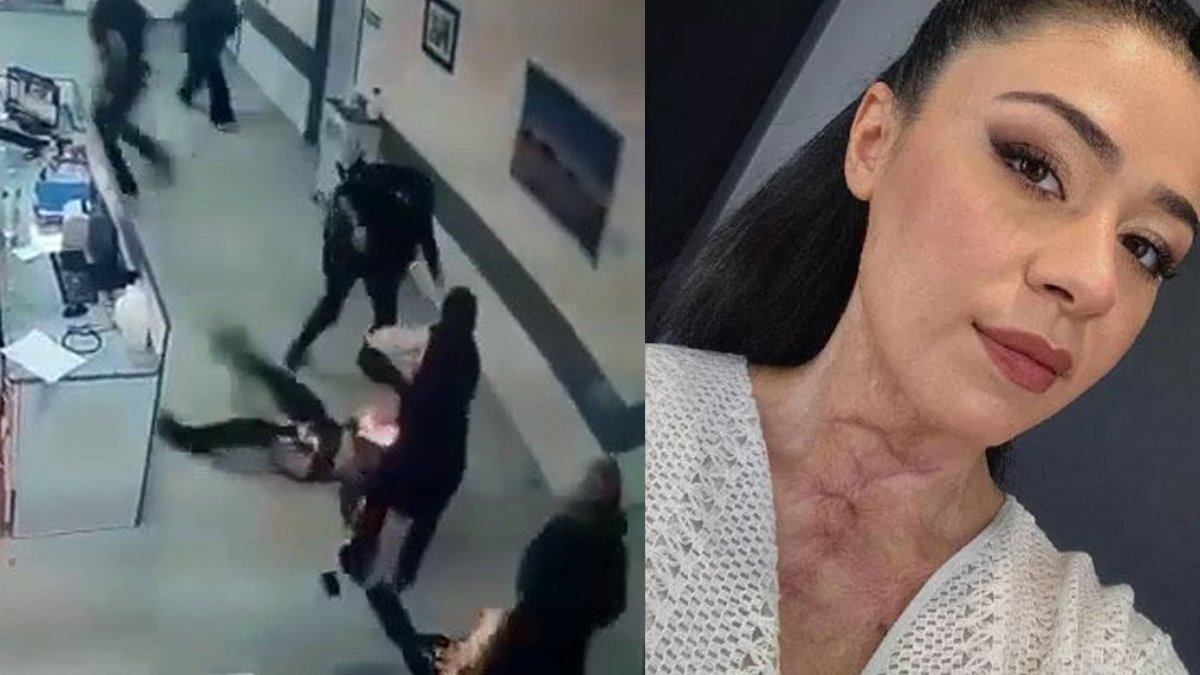 Meslektaşını yaralayan hemşirenin ifadesi ortaya çıktı: Çakmak çakıp 'Yakayım mı sizi' diye sormuş