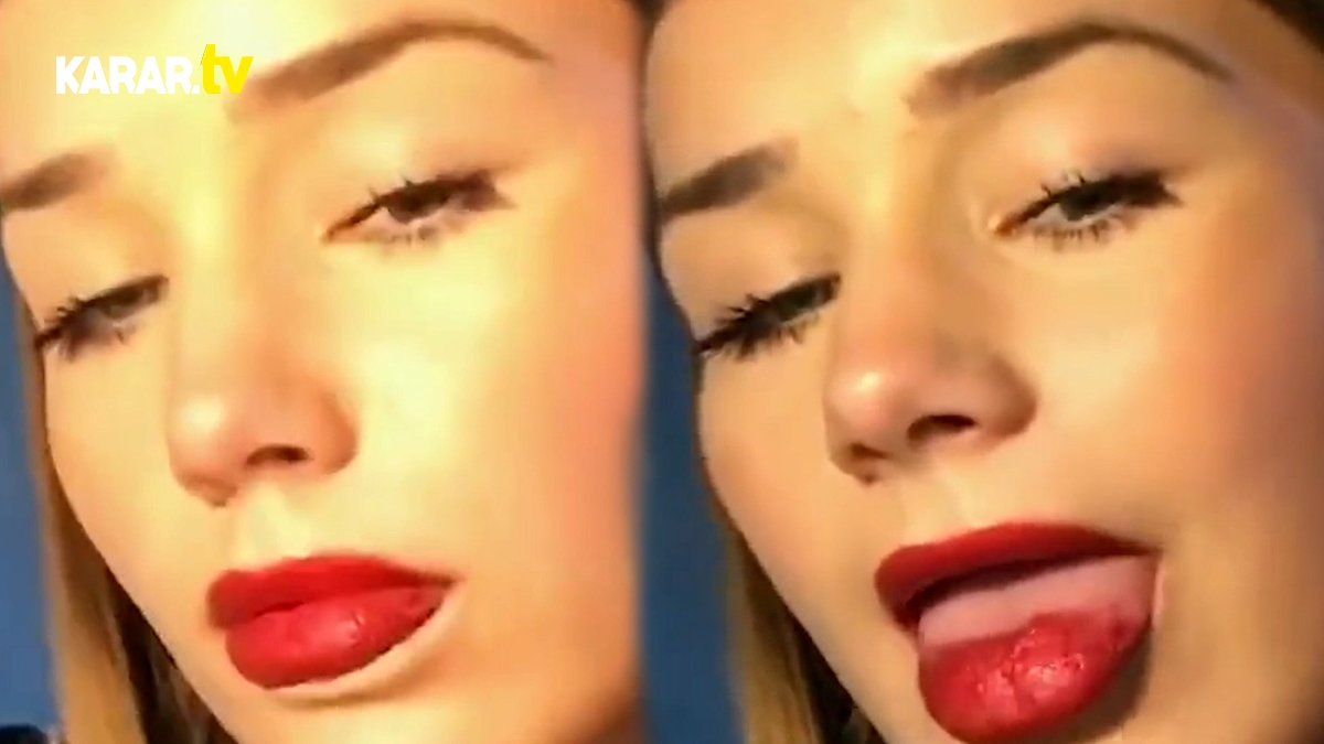 İnfluencerların hilesi açığa çıktı! Demek dudakları bu yüzden dolgun görünüyormuş...