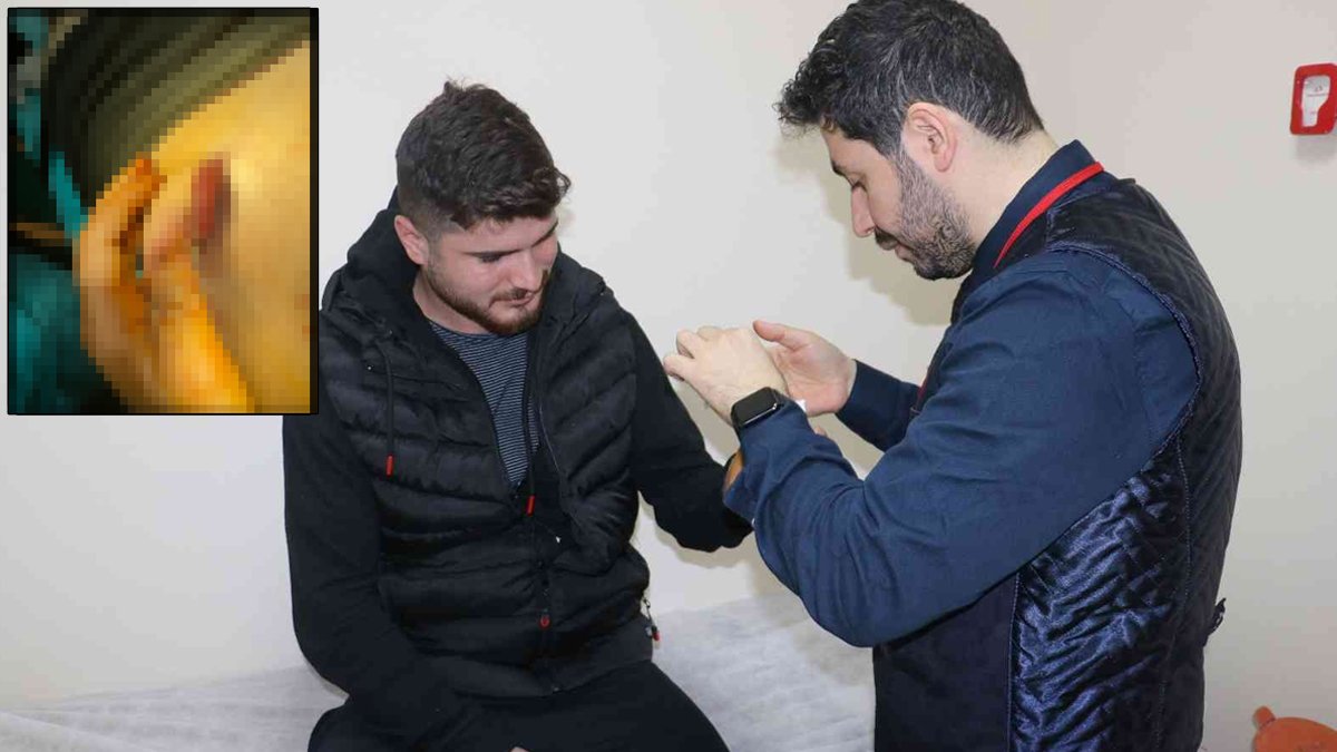 Kazada yarısını kaybetmişti: Göbeğinde büyüttüler