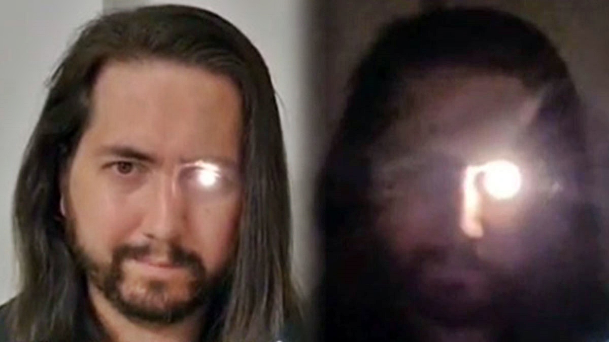 Kaybettiği gözünün yerine öyle bir şey taktı ki görenler hayrete düştü! Yok artık Tony Stark...