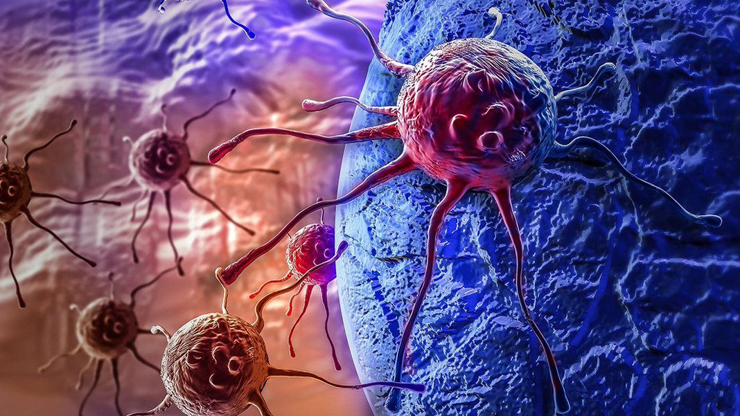 Tümörlü hücreye 'manyetik' darbe: Türk bilim insanlarından kanserle mücadelede çığır açan keşif