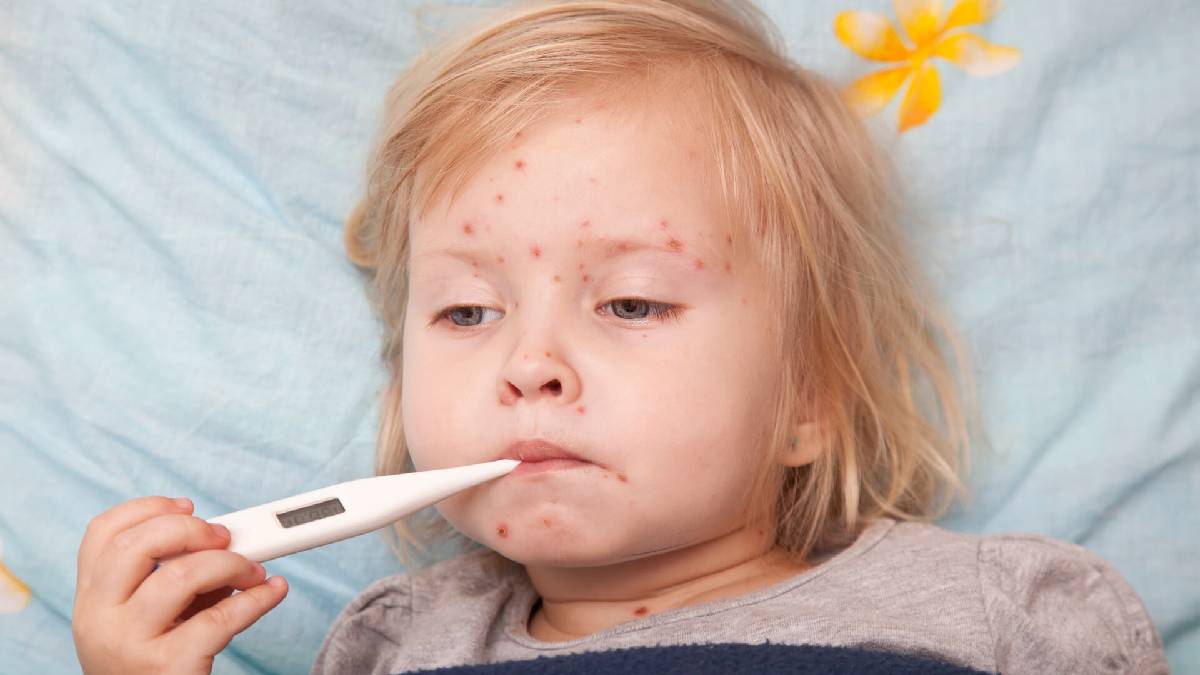 Anne ve babalar dikkat! Kızamık yeniden hortladı, özellikle o ilde vakalar çok arttı