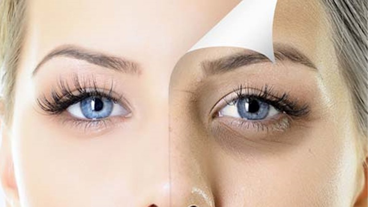 Bu basit numara, gözlerinizin altındaki koyu halkaları silgi gibi silip atıyor! Uygulayan herkes kozmetik ürünlere para dökmüyor