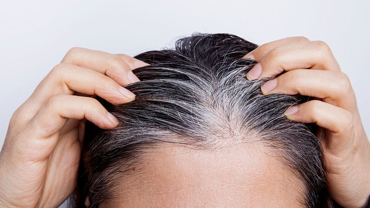 Beyaz saçları silgi gibi silecek bu yöntemi mutlaka deneyin! İşte beyaz saçlardan kurtulmanın en kolay yolu!