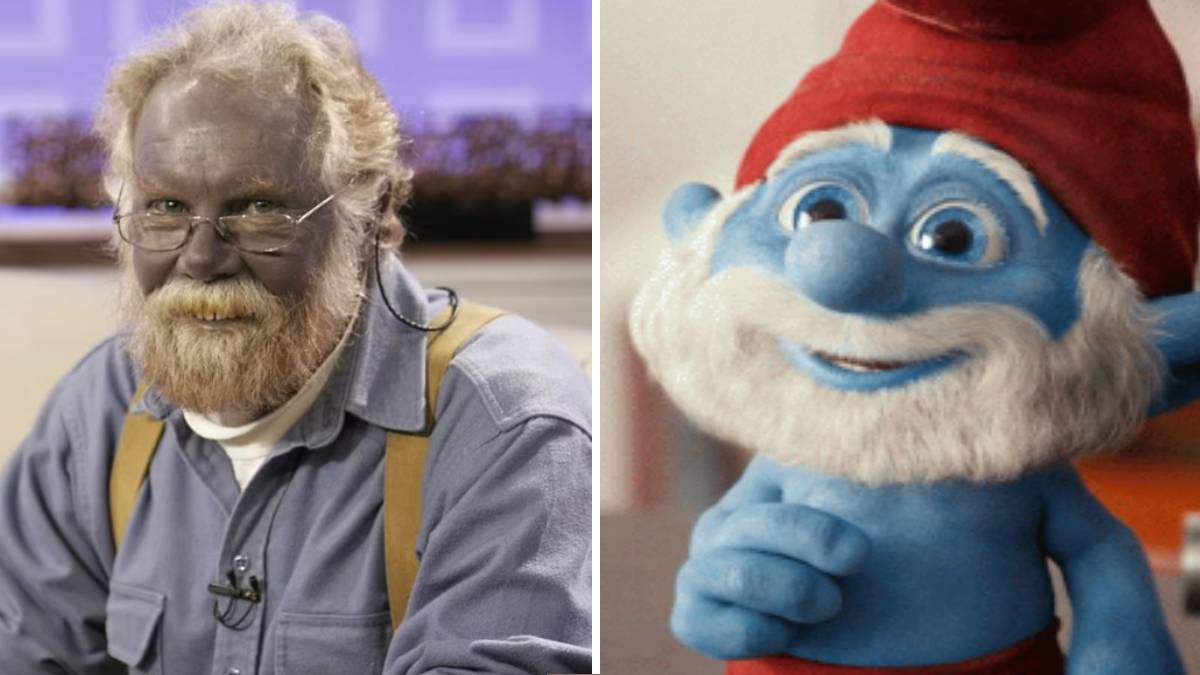 Gerçek Şirin Baba'nın videosu yıllar sonra ortaya çıktı! Görenler gözlerine inanamadı: Uyguladığı tedaviyle bu hale gelmişti