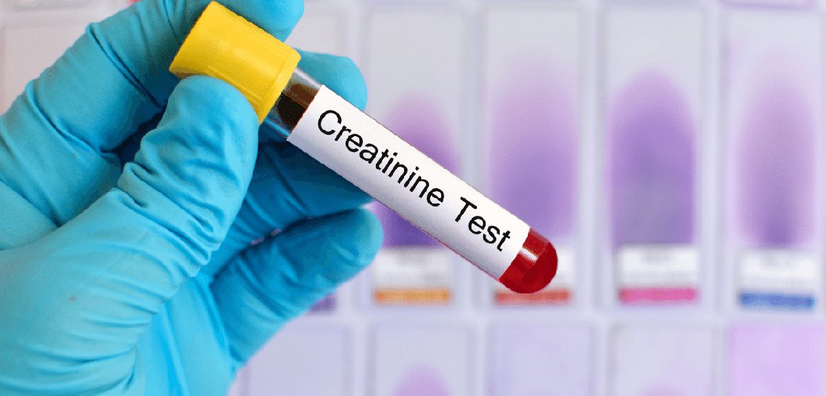 Kreatinin Nedir? Vücutta Üretilen Bu Maddelerin Önemi ve İşlevi