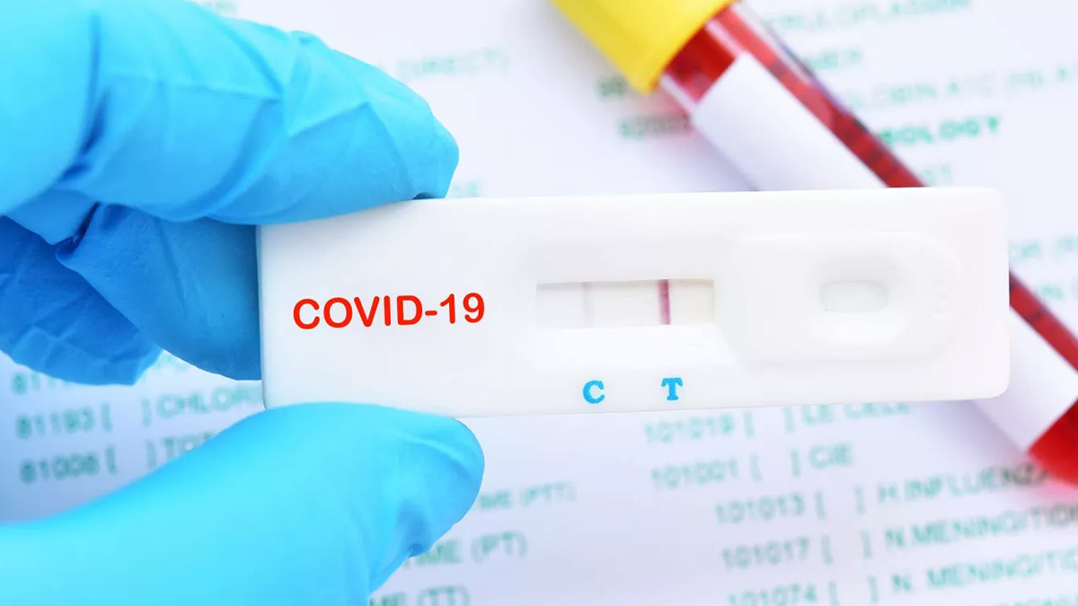 Korona testi sonucu ne zaman çıkar?