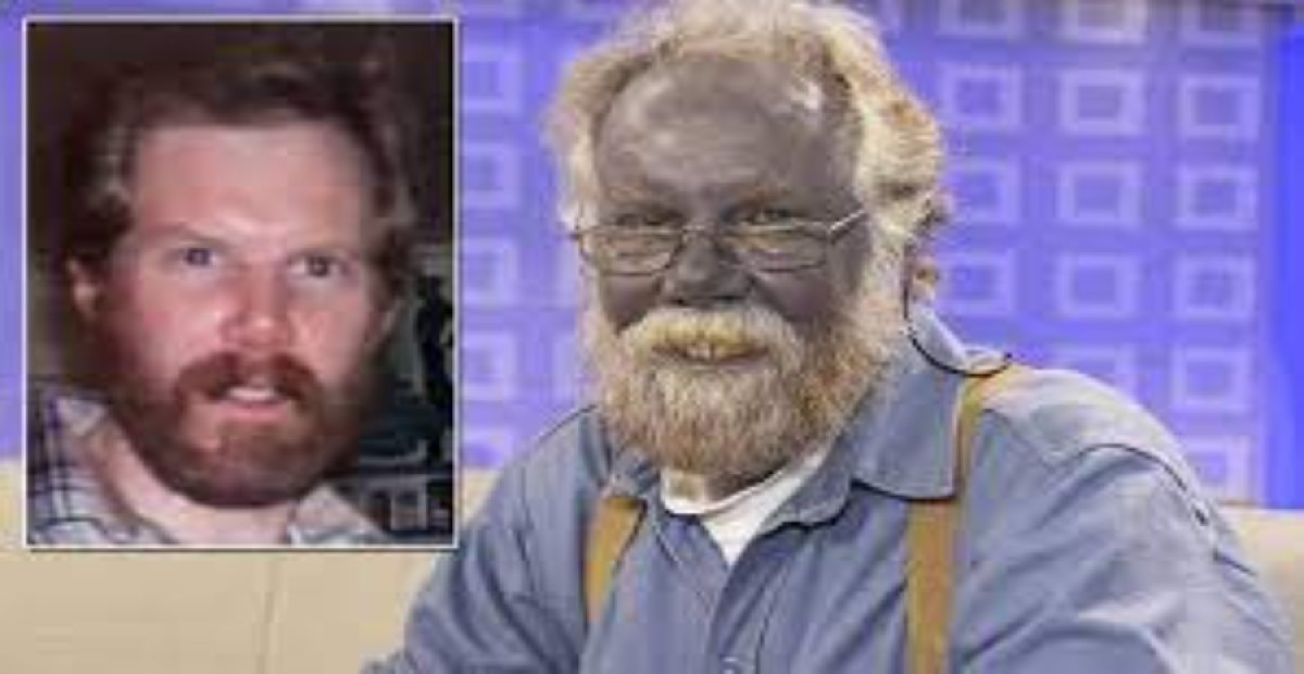 Bu hatayı yapanların ten rengi mora dönüşüyor! Asla aklınızdan bile geçirmeyin: O hastalığın sebebi buymuş!