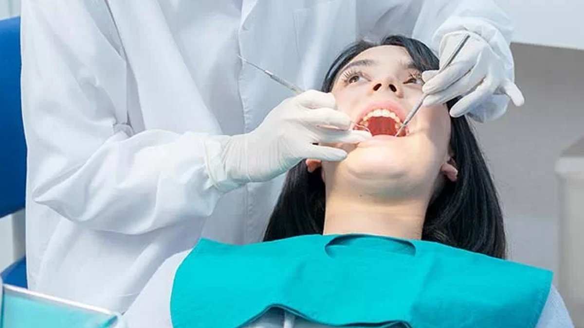 20'lik diş çekimi sonrası ağrı nasıl geçer?