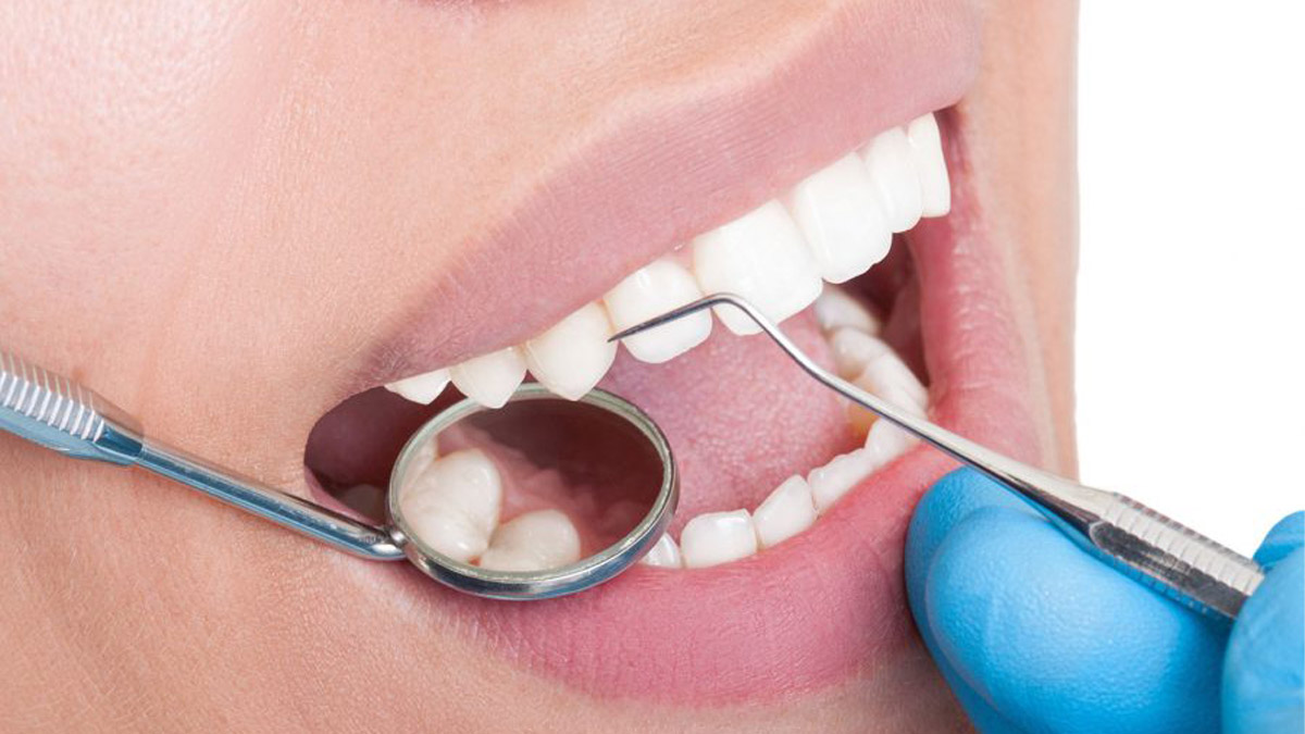 20 lik diş ne zaman çıkar?