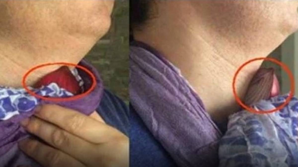 Boynunuza gece soğan bağlayın sabah mucizeye uyanın! Bu basit ve etkili yöntem hayatınızı değiştirecek