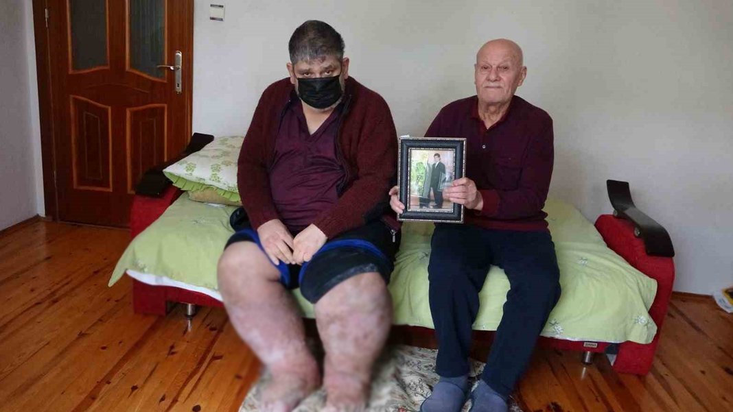 Sivrisinek ısırığı hayatını kararttı: 9 yıldır yürüyemiyor