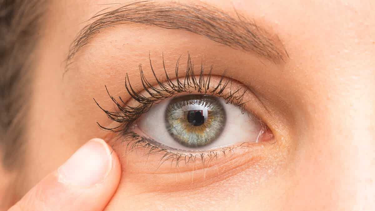 Gözlerdeki şişlik gizli kalp hastalığının habercisi olabilir