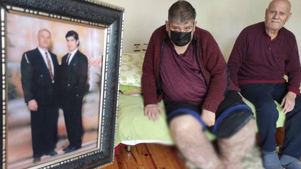 Sinek ısırığı ölüme götürmüştü: Bu illerde yaşayanlar dikkat!