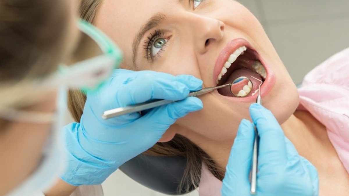 Evde diş taşı temizliği nasıl yapılır?