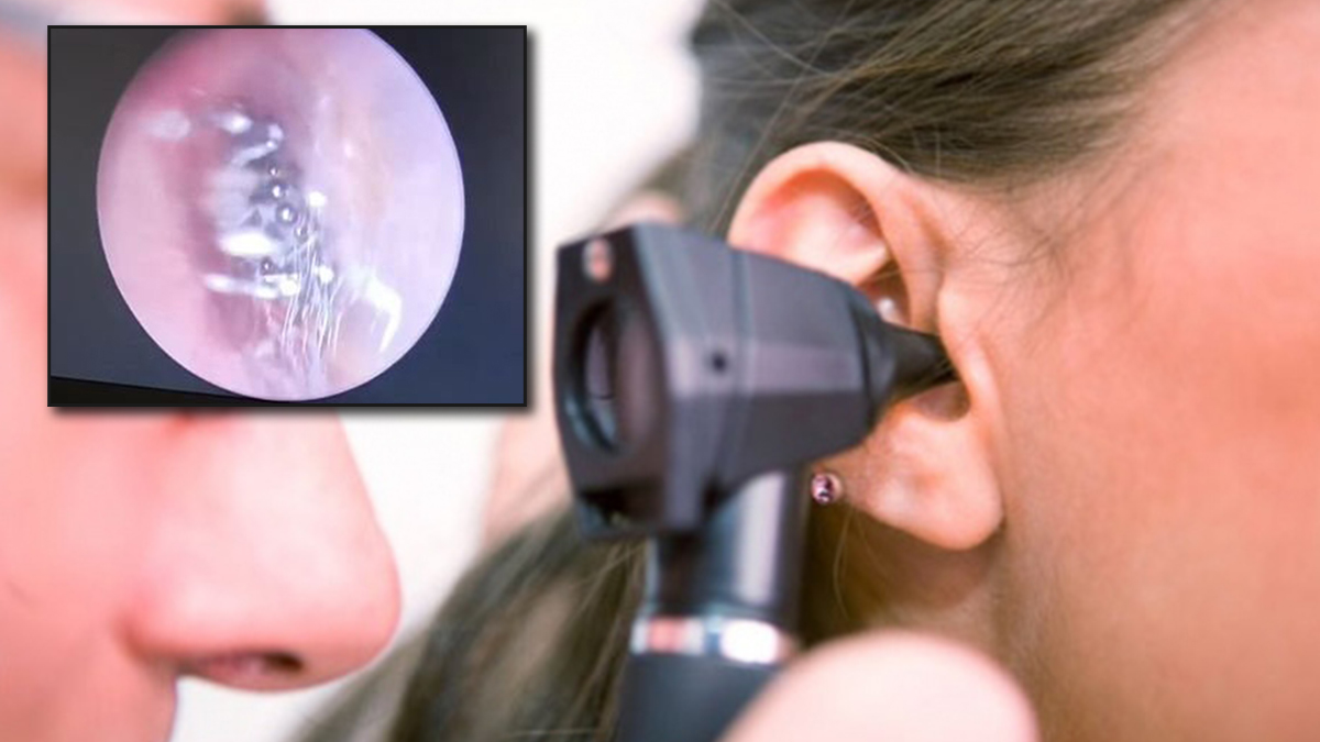 Rahatsızlığı nedeniyle doktora gitti, kulağından örümcek çıktı