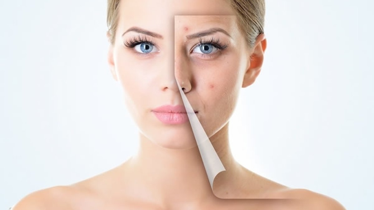 Yara İzleri Nasıl Geçer?