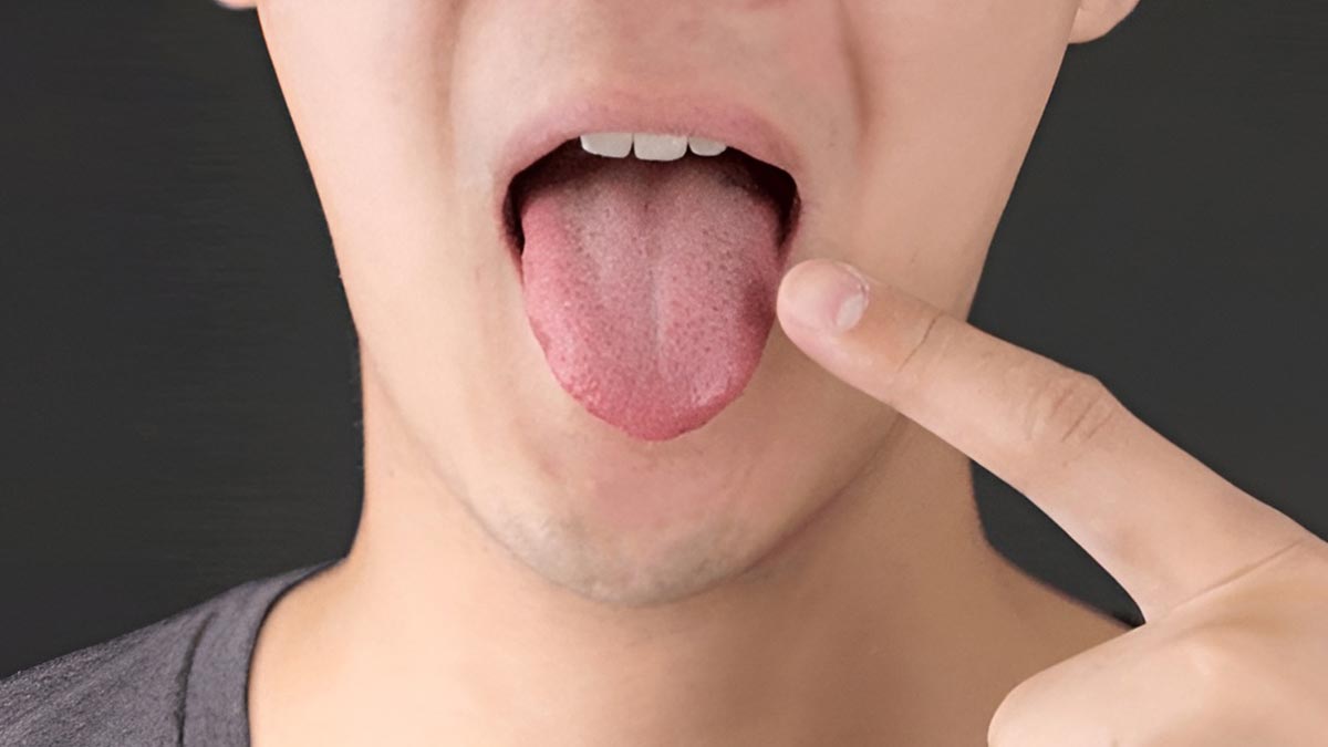 Diliniz böyle bir görüntüye sahipse dikkat! Ölümcül hastalık belirtisi olabilir, hemen kontrol edin