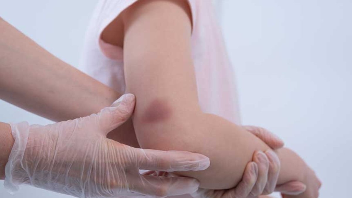 Vücutta Morarma Neden Olur?