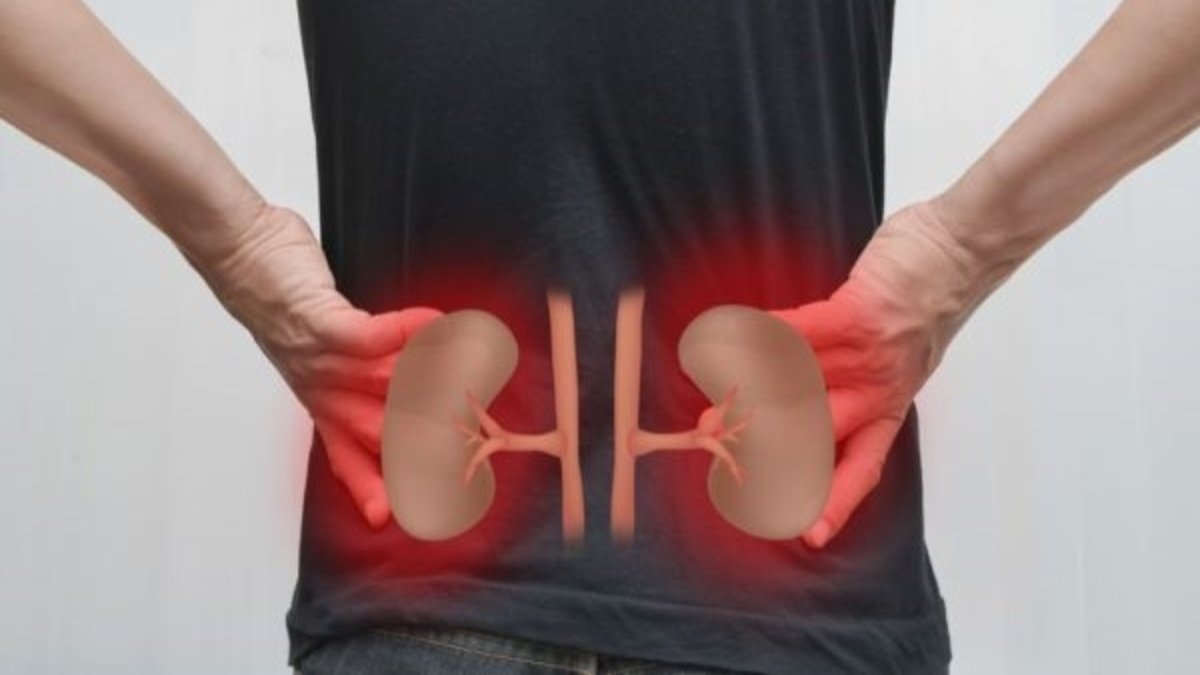 Böbrek Taşı Ağrısına Ne İyi Gelir?